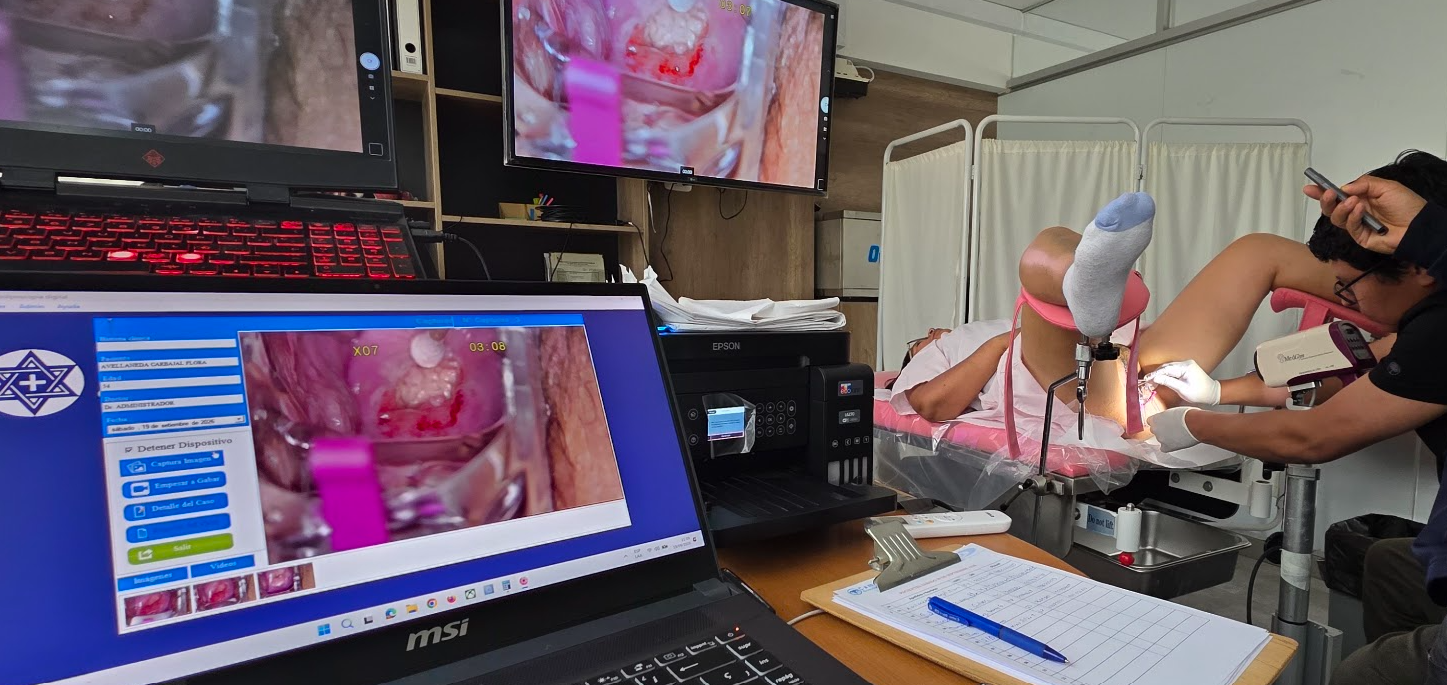 Diplomado Internacional Colposcopia Octubre 2026